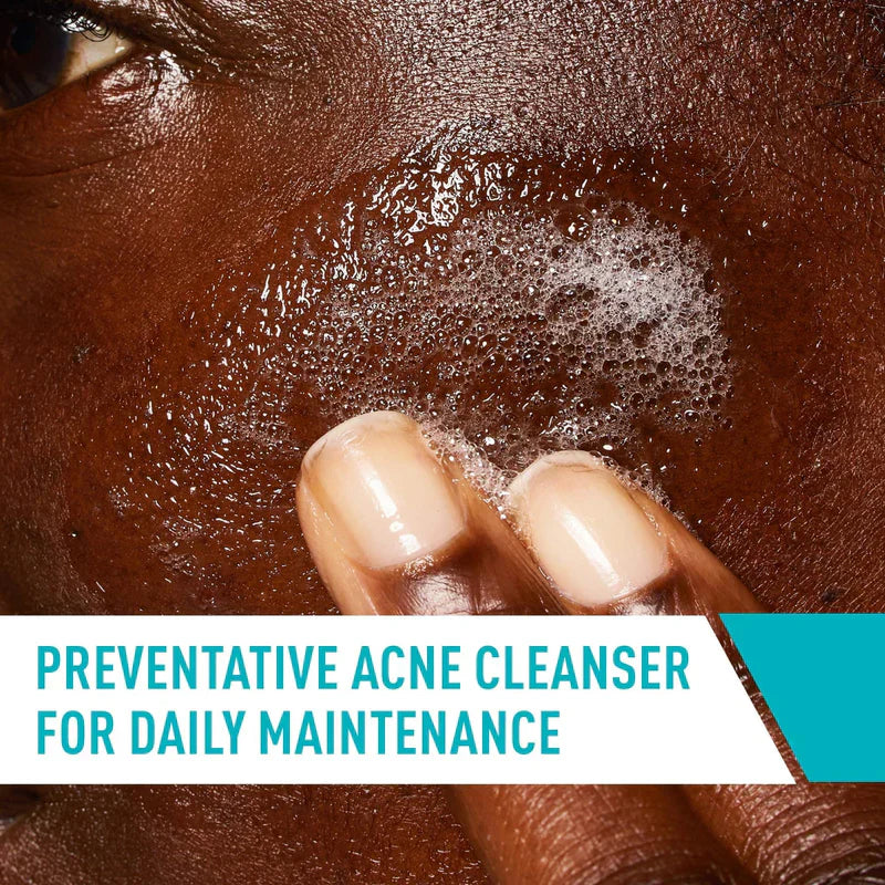 CeraVe Acne Control Cleanser 2% Salicylic Acid Acne Treatment