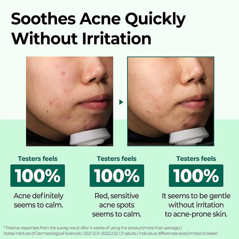 SOME BY MI AHA BHA PHA 30 Days Miracle Cream